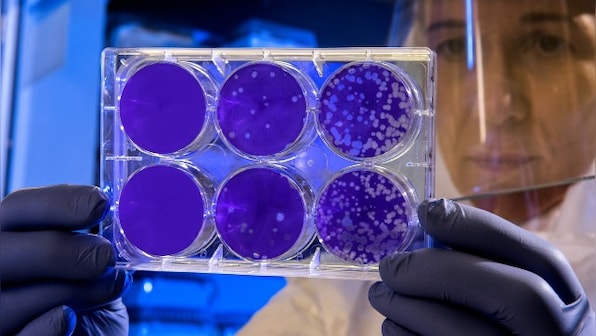Pleicomacrolides, a class of antibiotics, may help immune system kill HIV-infected cells, shows study