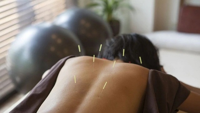 Acupuncture may help with inflammation and sepsis, a life-threatening condition seen in COVID-19 patients Acupuncture may help with inflammation and sepsis, a life-threatening condition seen in COVID-19 patients