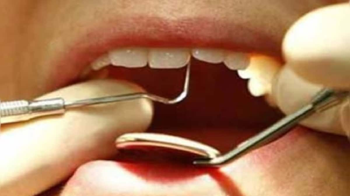 American scientists find technique to prevent dental cavities; flossing, cutting down sugar among ways to protect teeth