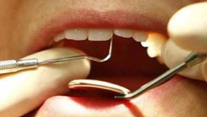 American scientists find technique to prevent dental cavities; flossing, cutting down sugar among ways to protect teeth
