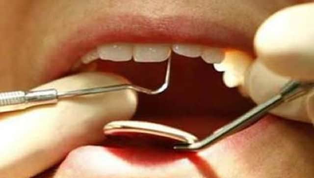 American scientists find technique to prevent dental cavities; flossing, cutting down sugar among ways to protect teeth American scientists find technique to prevent dental cavities; flossing, cutting down sugar among ways to protect teeth