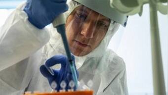 Elevated levels of plasmin in body may be reason behind severe COVID-19 in patients with comorbidities