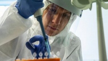 Elevated levels of plasmin in body may be reason behind severe COVID-19 in patients with comorbidities