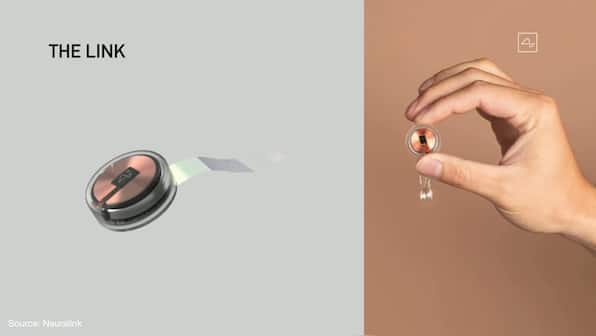 Elon Musk demonstrates how a Neuralink chip brain implant works – in a pig