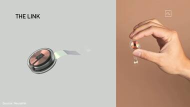 Elon Musk demonstrates how a Neuralink chip brain implant works – in a pig