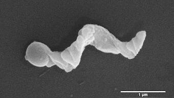 Indian researchers use 'nanomotors' as detectors that can read cancer environment
