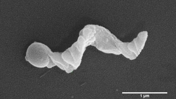 Indian researchers use 'nanomotors' as detectors that can read cancer environment