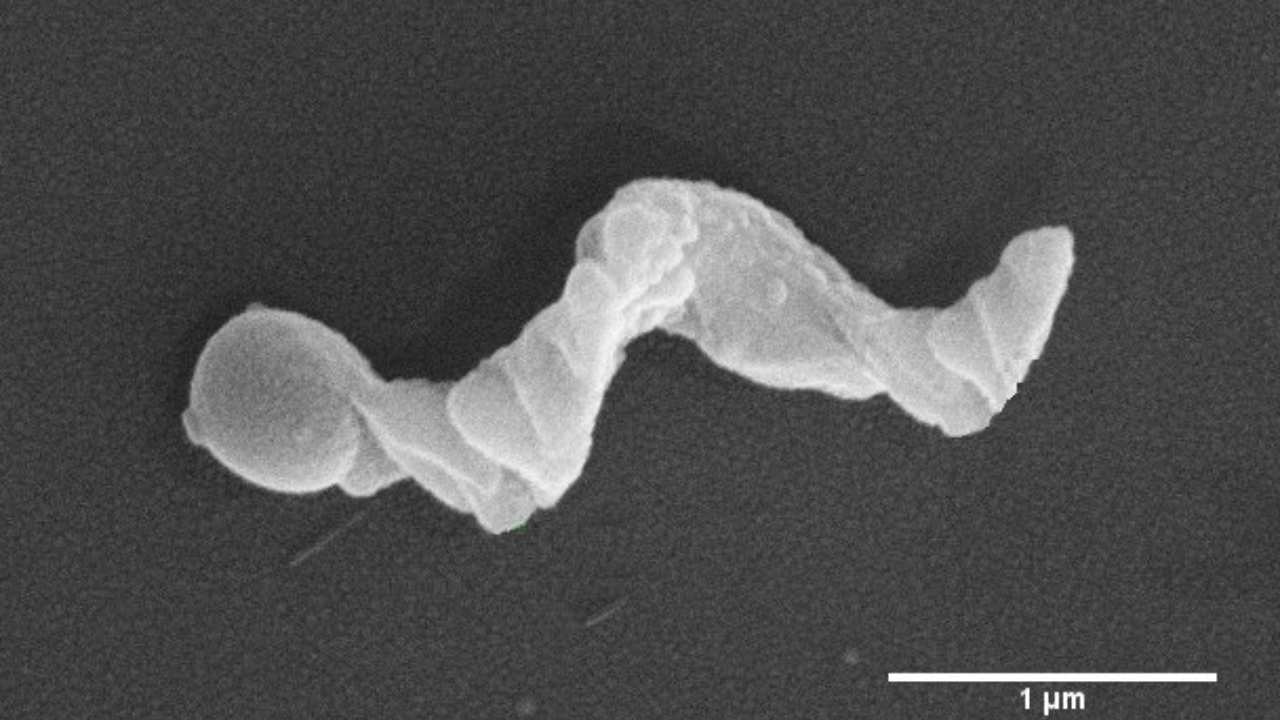 Indian researchers use 'nanomotors' as detectors that can read cancer environment Indian researchers use 'nanomotors' as detectors that can read cancer environment