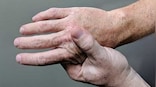World Arthritis Day 2022: Theme, history and significance