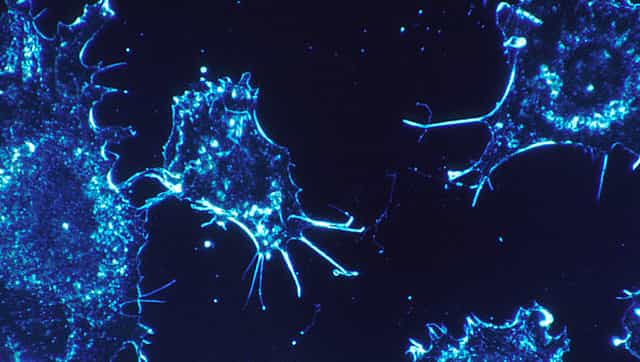 The fungal compound beta-glucan can be used to train the innate immune system that targets cancer cells, the study says.