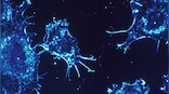 Young onset of esophageal cancer is rare but on the rise: Study says poor five-year survival rate likely among patients