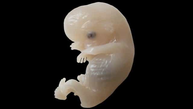 Researchers discover compound found in common plants can be used to treat Down syndrome in fetus Researchers discover compound found in common plants can be used to treat Down syndrome in fetus