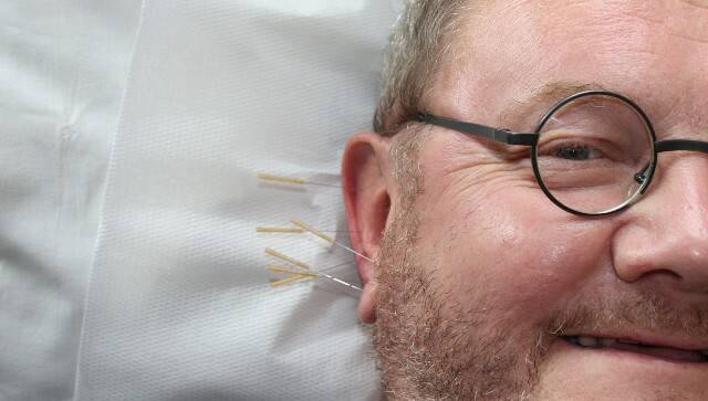 Battlefield acupuncture is a technique where needles are placed inside the ear to reduce pain in the body. Walti Göhner/Pixabay