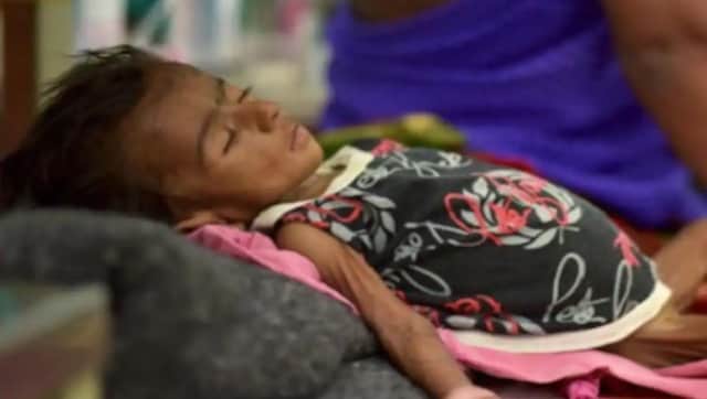 As Haiti struggles with COVID-19 pandemic, severe acute malnutrition spikes among children