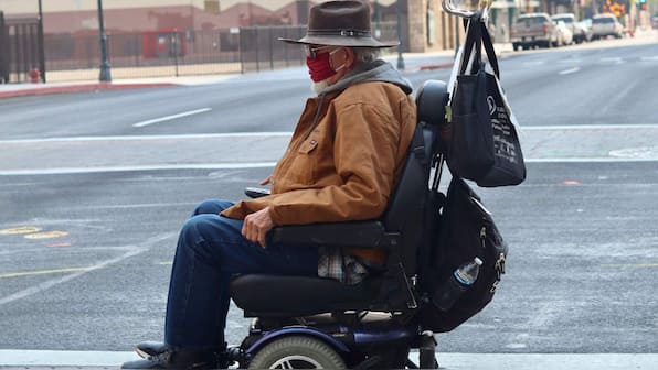 Doctors see some signs of recovery in patients who suffered from severe COVID-19 lung damage