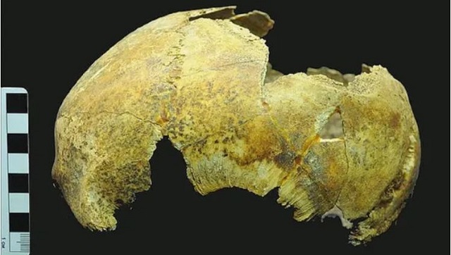 Russian Scientists discover 5,000-year-old skull of failed brain surgery patient in Crimea Russian Scientists discover 5,000-year-old skull of failed brain surgery patient in Crimea