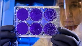 New immunotherapy for influenza virus infections may also help fight HIV and COVID-19, study suggests