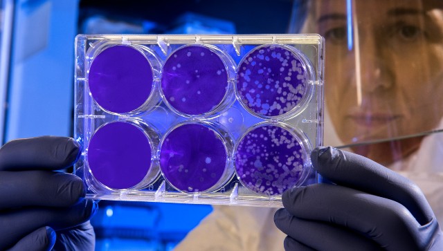 New immunotherapy for influenza virus infections may also help fight HIV and COVID-19, study suggests New immunotherapy for influenza virus infections may also help fight HIV and COVID-19, study suggests