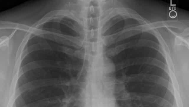 Chest pain and vomiting too dangerous combination to ignore, consulting doctor immediately a must Chest pain and vomiting too dangerous combination to ignore, consulting doctor immediately a must