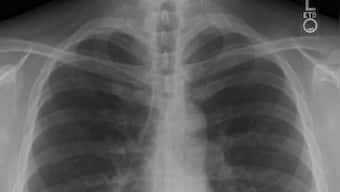 Chest pain and vomiting too dangerous combination to ignore, consulting doctor immediately a must