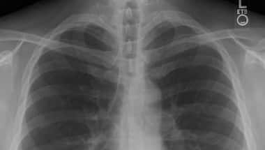 Chest pain and vomiting too dangerous combination to ignore, consulting doctor immediately a must
