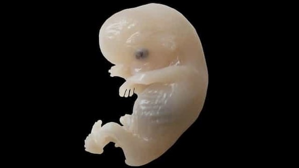 Prenatal exposures to COVID-19 even without maternal infection will affect future generations, claims study