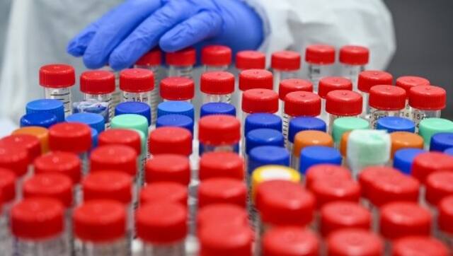A laboratory staff wearing Personal Protective Equipments (PPE) places a hand on samples collected for Covid-19 coronavirus testing. AFP