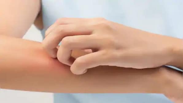 Why does the immune system respond to allergens by triggering itching in the skin?