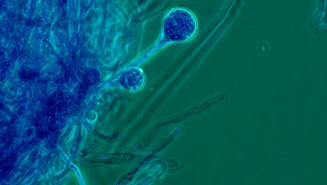 Fungal disease | Latest News on Fungal-disease | Breaking ...