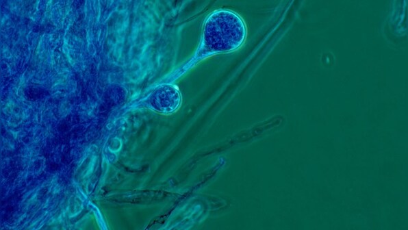 COVID-19-triggered mucormycosis cases rise in India: Symptoms, treatment and risk factors of deadly black fungal infection