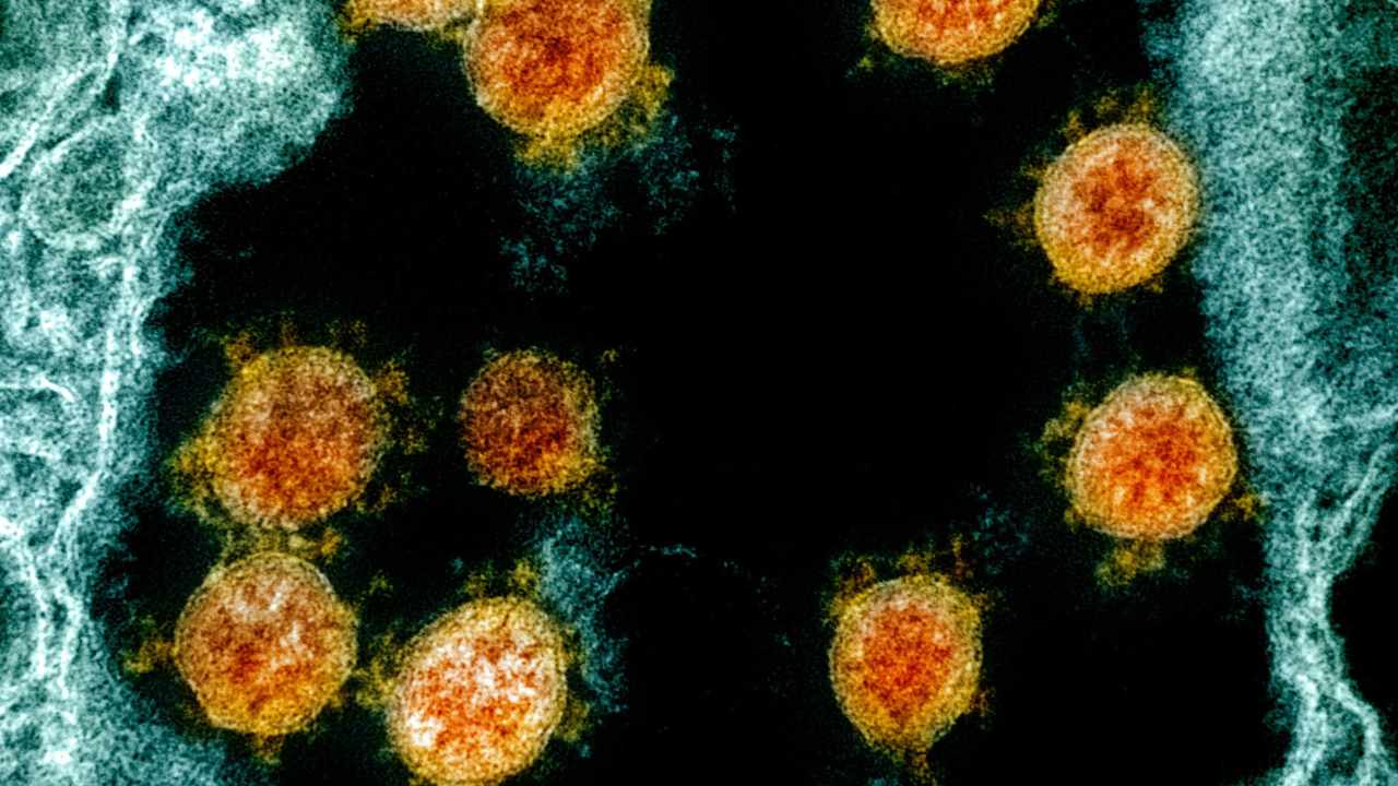 Transmission electron micrograph of SARS-CoV-2 virus particles (orange) isolated from a patient. Image Credit: NIH