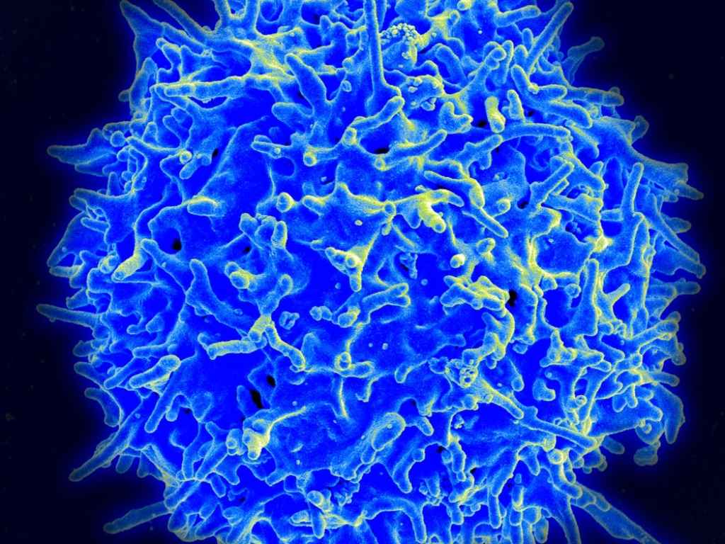 COVID–19 vaccines produce a strong immune response in terms of both antibodies and T cells, like the T cell in this photo. Image credit: National Institutes of Allergy and Infectious Diseases/National Institutes of Health