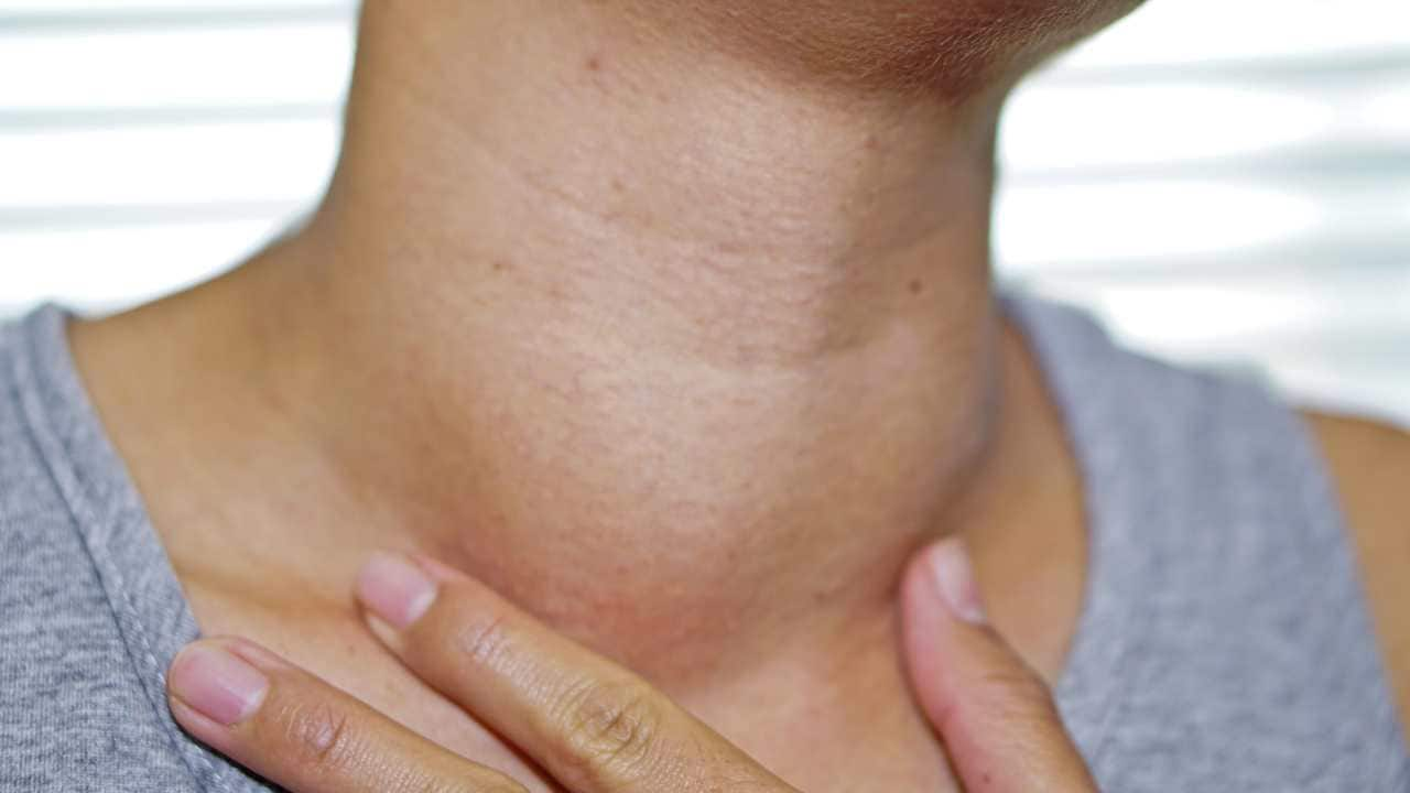 enlargened lymph nodes on back of head