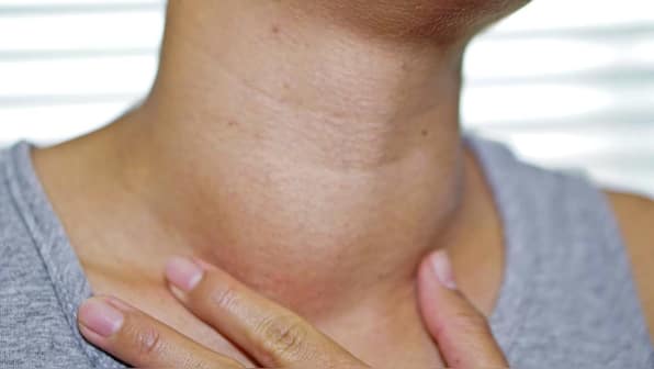 Enlarged lymph nodes after COVID-19 vaccination could be mistaken for cancer