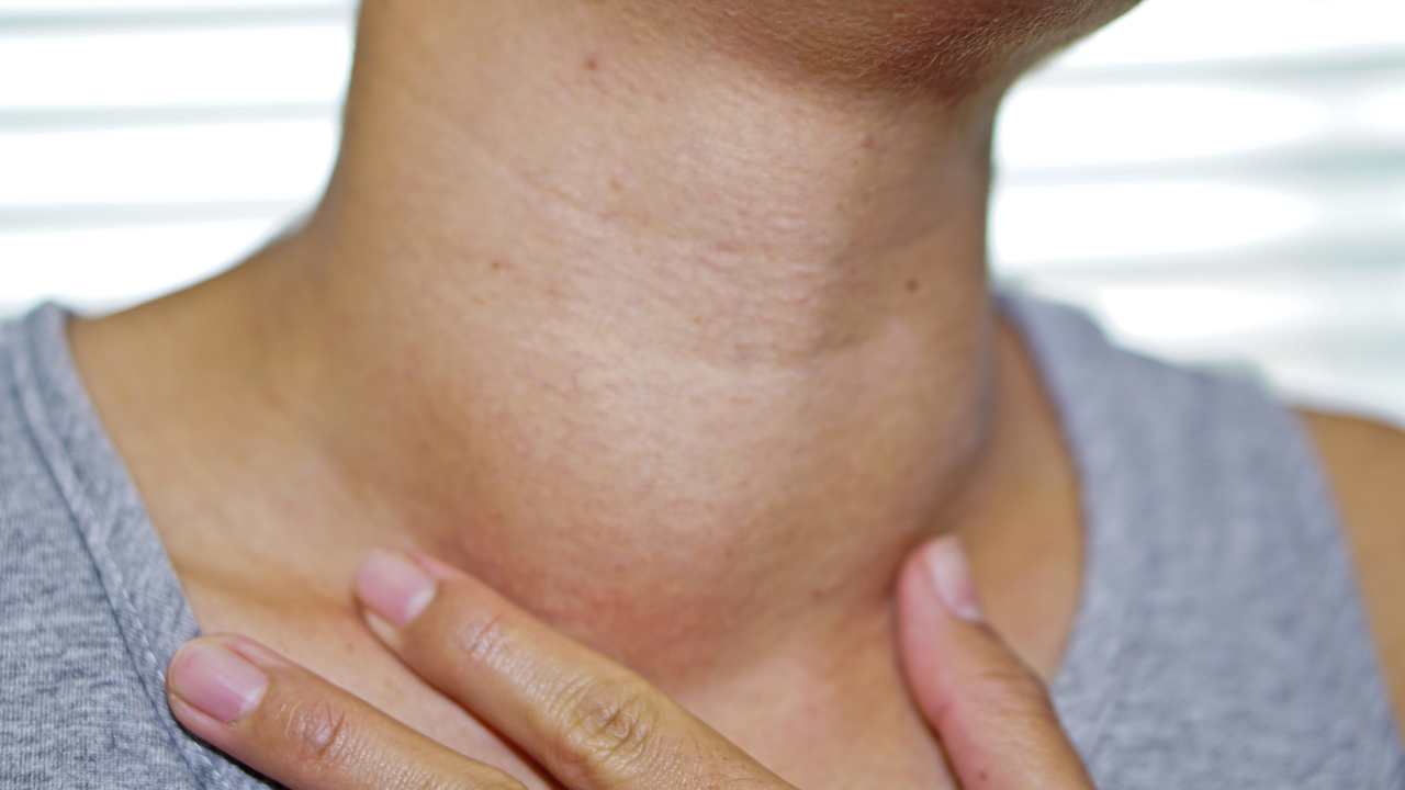 Enlarged lymph nodes after COVID-19 vaccination could be mistaken for cancer Enlarged lymph nodes after COVID-19 vaccination could be mistaken for cancer