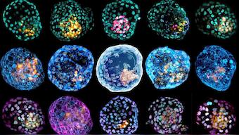 Pre-embryos made in a lab to study birth defects could spur research, ethical debate