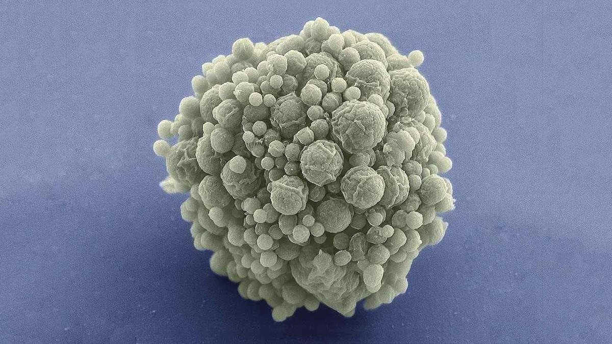 Synthetic bacteria-like 'minimal' cell can now divide and grow like natural cells do