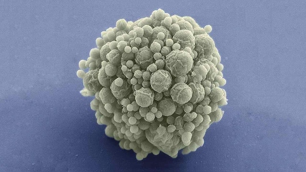 Synthetic bacteria-like 'minimal' cell can now divide and grow like natural cells do