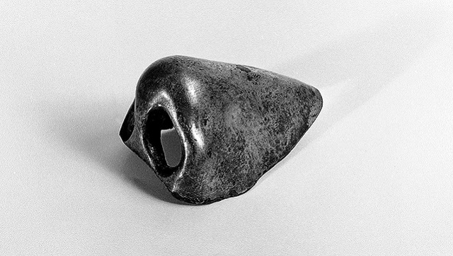 A 400-year-old botched nose job shows how little feelings, perceptions about transplants have changed A 400-year-old botched nose job shows how little feelings, perceptions about transplants have changed