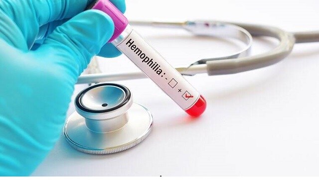 World Hemophilia Day 2021: Significance of day aimed at raising awareness about rare blood disorder
