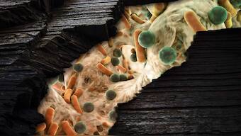 Earth day 2021: Microbial diversity is under threat which endangers the rest of the planet