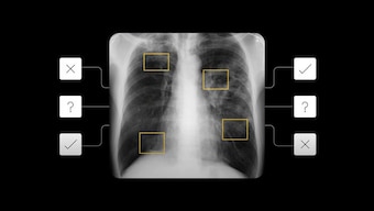 Google I/O 2021: AI tool to detect active pulmonary tuberculosis announced