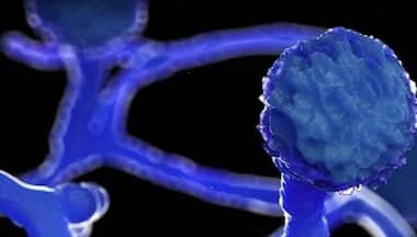 Two children from rural Karnataka contract black fungus; both critical