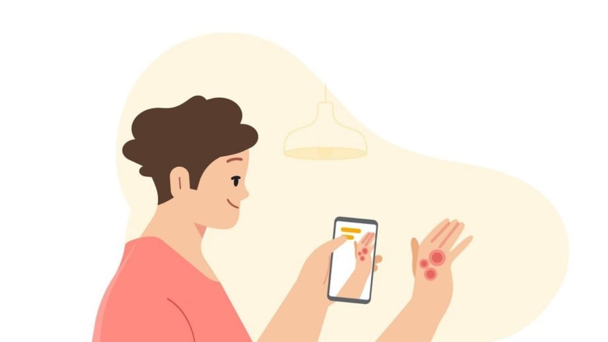 Google I/O 2021: Dermatology assist tool showcased, to help get info about common skin condition using smartphone camera