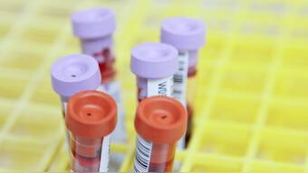 World Blood Cancer Day: Blood stem cell transplant can give patients a second chance at life