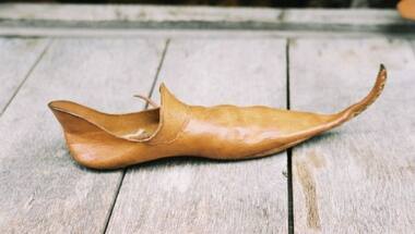 How Medieval England's trend for pointy shoes often led to bunions and broken bones
