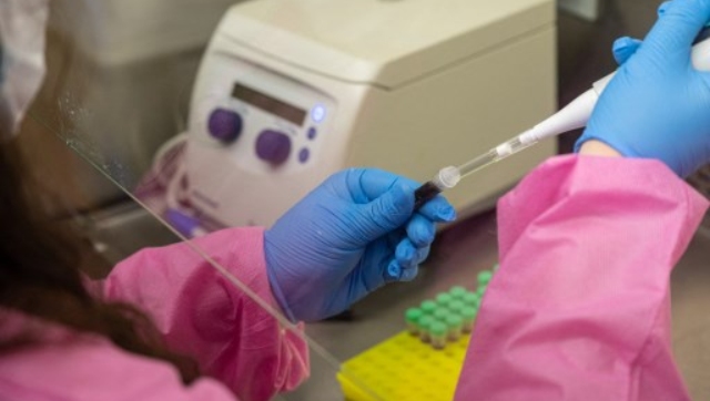 Russia warns of increase in West Nile Virus cases: What is it? What are its symptoms? Russia warns of increase in West Nile Virus cases: What is it? What are its symptoms?