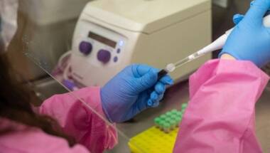 Russia warns of increase in West Nile Virus cases: What is it? What are its symptoms?