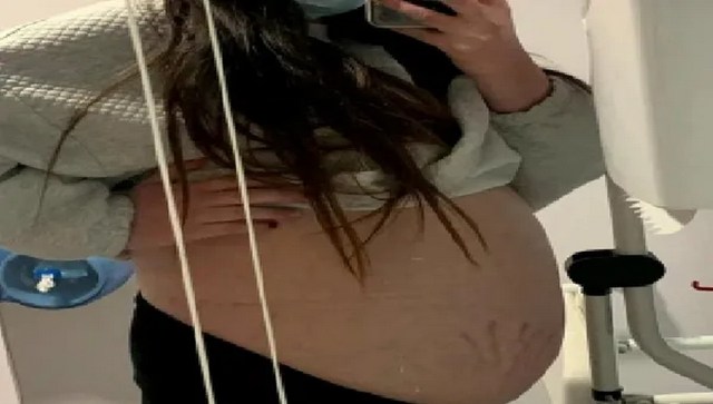 UK woman puzzled by weight gain discovers football-sized cyst in stomach after doctor's visit UK woman puzzled by weight gain discovers football-sized cyst in stomach after doctor's visit