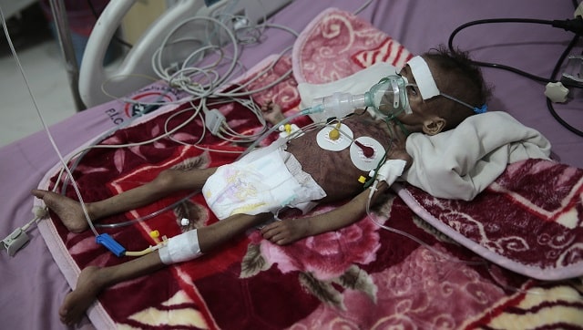 In war, 16 million Yemenis 'marching' toward starvation, warns UN agency In war, 16 million Yemenis 'marching' toward starvation, warns UN agency